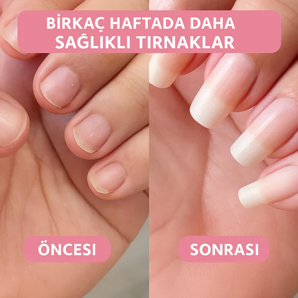 1Alana 1 Bedava! Tırnak Serumu
